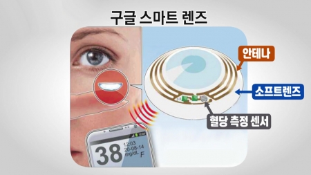 건강 파수꾼…'사물인터넷'