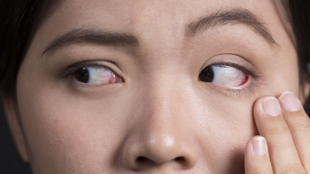 파르르 떨리는 눈…안면 신경 질환 시작일 수 있다?