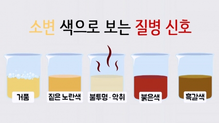 내 몸이 보내는 건강적신호…소변 상태로 보는 질병
