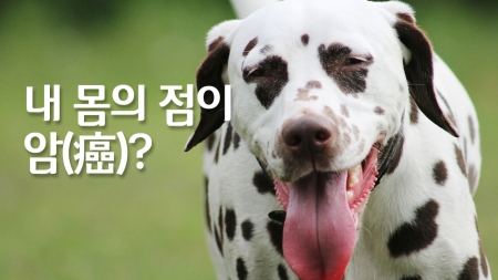 내 몸의 점, 점점 커진다면 암일 수도