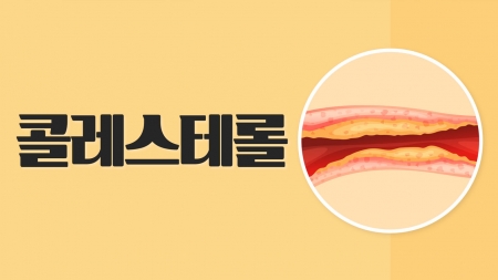 아메리카노가 콜레스테롤 높인다?