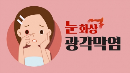 선글라스 렌즈 짙을수록 좋다?